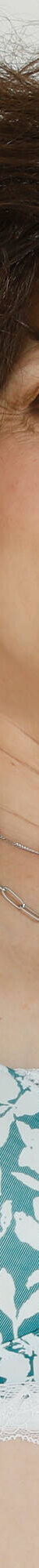 Soutien-gorge post-opératoire en coton stretch imprimé - sans armatures (émeraude) Soutien-gorge post-opératoire en coton stretch imprimé - sans armatures (émeraude)